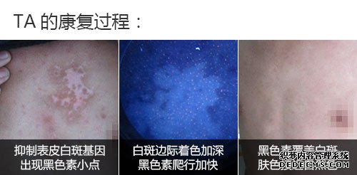 500案例胸前TA的康复过程.jpg