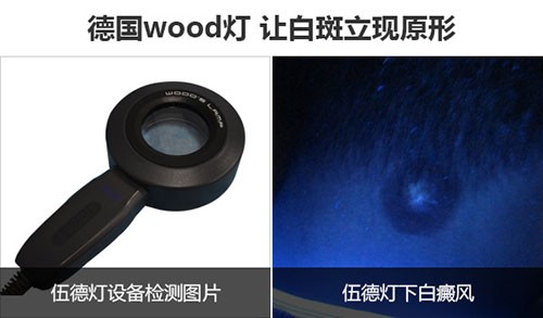 580wood灯设备颈部.jpg