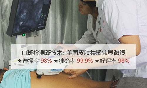 500技术CT背部.jpg
