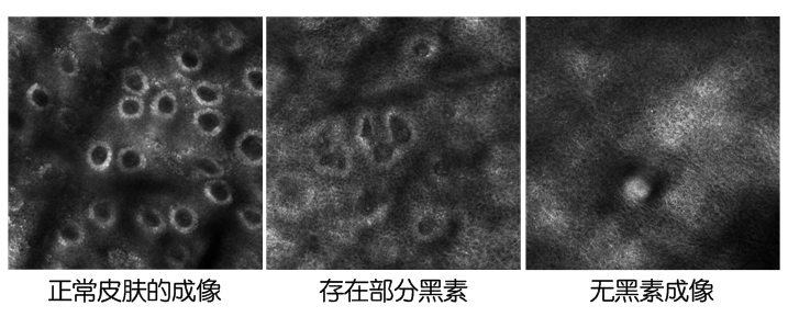 兰州中医白癜风医院第46场案例指导交流的通知