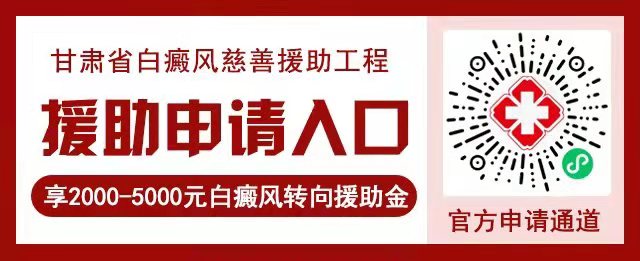 暑期白癜风“看名医不难”郑艳红莅临兰州中医进行案例会诊